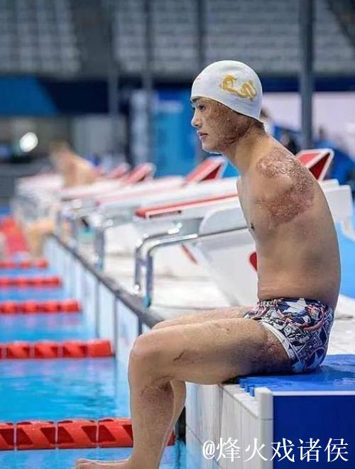 全国残特奥会|“无臂飞鱼”袁伟译:勇敢迈向“第二道坎” 全国残特奥会|“无臂飞鱼”袁伟译:勇敢迈向“第二道坎”